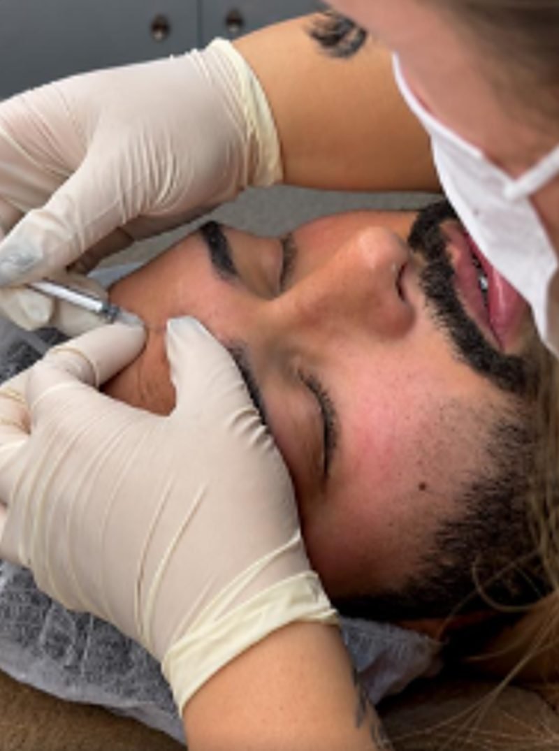Dra. Kamilla aplicando Botox no rosto de um paciente homem